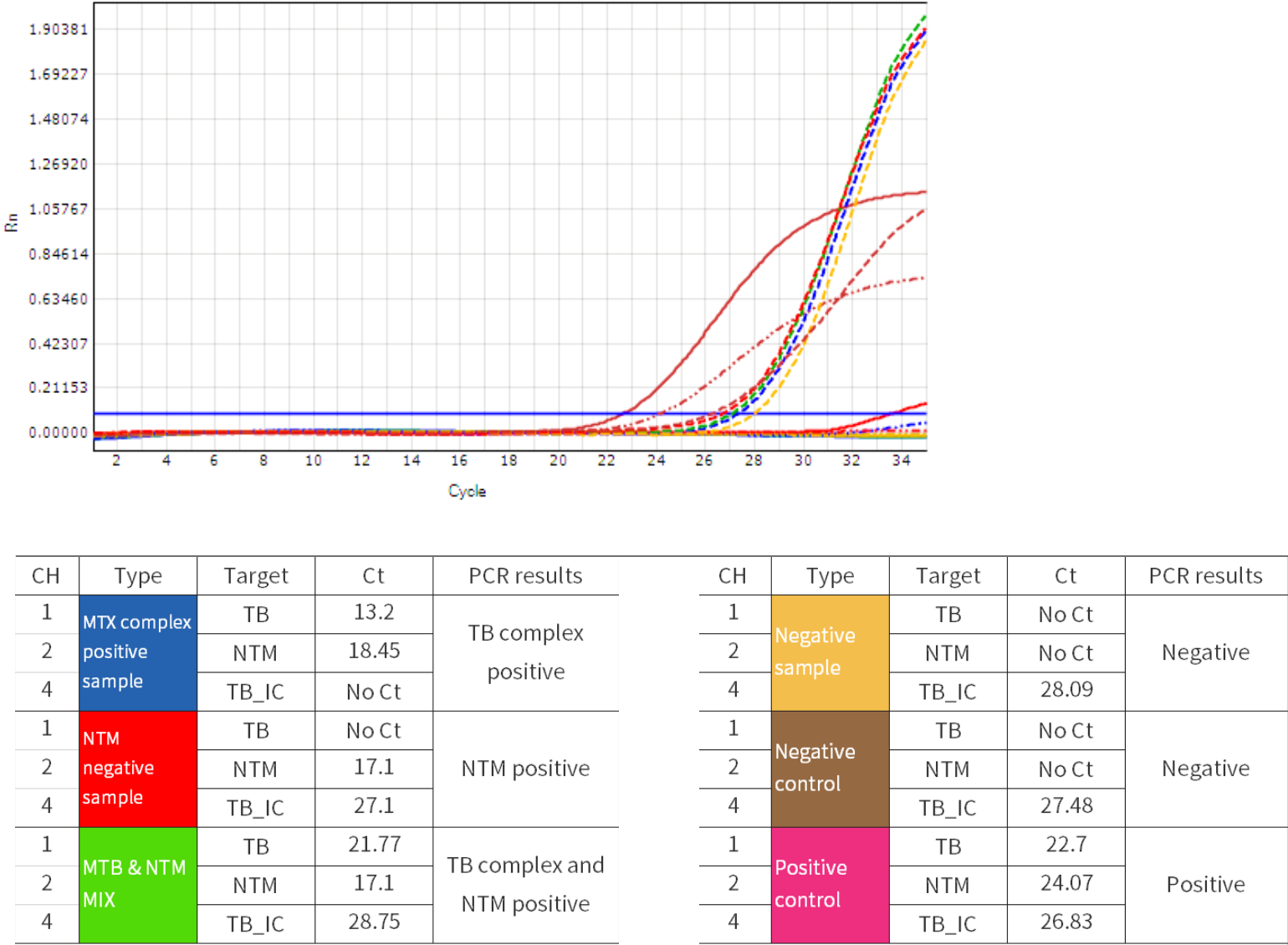 TB Real-time PCR 세포이미지 